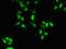 Homeobox protein OTX1 antibody, LS-C678910, Lifespan Biosciences, Immunofluorescence image 