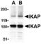 Elongator Complex Protein 1 antibody, MBS150596, MyBioSource, Western Blot image 