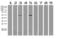 4-Aminobutyrate Aminotransferase antibody, LS-C796917, Lifespan Biosciences, Western Blot image 