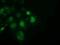 Sepiapterin Reductase antibody, MA5-25309, Invitrogen Antibodies, Immunocytochemistry image 
