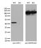 PDZ domain-containing protein GIPC1 antibody, M04969, Boster Biological Technology, Western Blot image 