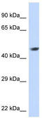 Nuclear Receptor Subfamily 2 Group E Member 1 antibody, TA334016, Origene, Western Blot image 