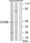 Choline/ethanolamine kinase antibody, abx013859, Abbexa, Western Blot image 