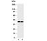 Coi antibody, R30377, NSJ Bioreagents, Western Blot image 