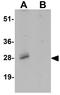 Shisa Family Member 3 antibody, GTX32109, GeneTex, Western Blot image 