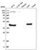Rhomboid Like 1 antibody, PA5-65063, Invitrogen Antibodies, Western Blot image 