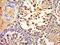 Charcot-Leyden Crystal Galectin antibody, orb157023, Biorbyt, Immunohistochemistry paraffin image 