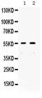 X-Ray Repair Cross Complementing 4 antibody, PB9908, Boster Biological Technology, Western Blot image 