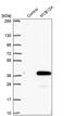 Multivesicular Body Subunit 12A antibody, PA5-59924, Invitrogen Antibodies, Western Blot image 