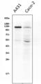 Cadherin 3 antibody, M03353, Boster Biological Technology, Western Blot image 