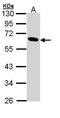 Pancreatic Lipase antibody, TA308036, Origene, Western Blot image 
