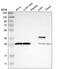 Aminocarboxymuconate Semialdehyde Decarboxylase antibody, HPA010533, Atlas Antibodies, Western Blot image 