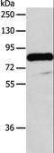 ADAM Metallopeptidase Domain 32 antibody, LS-C404445, Lifespan Biosciences, Western Blot image 