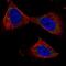 Protein Phosphatase 3 Catalytic Subunit Beta antibody, NBP2-58920, Novus Biologicals, Immunocytochemistry image 