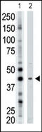 ADP-Ribosyltransferase 3 antibody, AP12146PU-N, Origene, Western Blot image 