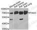 Protein Inhibitor Of Activated STAT 3 antibody, A7060, ABclonal Technology, Western Blot image 