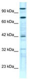 Zinc Finger Protein 23 antibody, TA333496, Origene, Western Blot image 