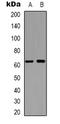 Amyloid protein-binding protein 2 antibody, LS-C368766, Lifespan Biosciences, Western Blot image 