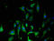 SYK antibody, A64076-100, Epigentek, Immunofluorescence image 