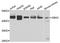 Glucosylceramidase Beta 3 (Gene/Pseudogene) antibody, A7827, ABclonal Technology, Western Blot image 