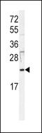 HRas Proto-Oncogene, GTPase antibody, 63-189, ProSci, Western Blot image 
