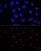 KRR1 Small Subunit Processome Component Homolog antibody, GTX66443, GeneTex, Immunocytochemistry image 