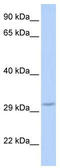 F-Box Protein 27 antibody, TA344330, Origene, Western Blot image 