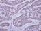 Calcium/Calmodulin Dependent Protein Kinase ID antibody, LS-C185689, Lifespan Biosciences, Immunohistochemistry frozen image 