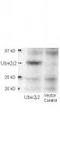 Ubiquitin-conjugating enzyme E2 J2 antibody, TA319512, Origene, Western Blot image 