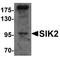 Salt Inducible Kinase 2 antibody, orb95661, Biorbyt, Western Blot image 