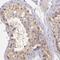 Leucine Rich Repeat Containing 18 antibody, FNab04854, FineTest, Immunohistochemistry frozen image 