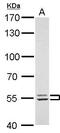 LYN Proto-Oncogene, Src Family Tyrosine Kinase antibody, GTX111584, GeneTex, Western Blot image 