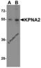 Karyopherin Subunit Alpha 2 antibody, 5983, ProSci, Western Blot image 