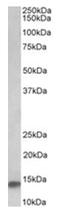 NADH:Ubiquinone Oxidoreductase Subunit A7 antibody, AP32032PU-N, Origene, Western Blot image 