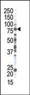 Ribophorin II antibody, AP12184PU-N, Origene, Western Blot image 
