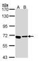 ATPase H+ Transporting V0 Subunit A4 antibody, GTX110255, GeneTex, Western Blot image 