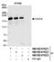 Uveal Autoantigen With Coiled-Coil Domains And Ankyrin Repeats antibody, NB100-61622, Novus Biologicals, Western Blot image 