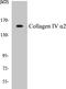 Collagen Type IV Alpha 2 Chain antibody, EKC1129, Boster Biological Technology, Western Blot image 