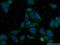 Proactivator polypeptide antibody, 18398-1-AP, Proteintech Group, Immunofluorescence image 