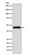 Somatostatin receptor type 5 antibody, M02892-1, Boster Biological Technology, Western Blot image 