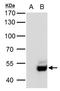 Ubiquitin Specific Peptidase 3 antibody, GTX128238, GeneTex, Western Blot image 