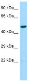 L-2-Hydroxyglutarate Dehydrogenase antibody, TA337982, Origene, Western Blot image 