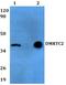 DMRT Like Family C2 antibody, A13789, Boster Biological Technology, Western Blot image 