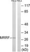 Mitochondrial Ribosome Recycling Factor antibody, TA315989, Origene, Western Blot image 