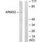 Armadillo Repeat Containing X-Linked 2 antibody, PA5-49840, Invitrogen Antibodies, Western Blot image 