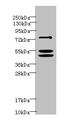 Forkhead Box P1 antibody, A68303-100, Epigentek, Western Blot image 