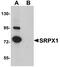 Sushi Repeat Containing Protein X-Linked antibody, A10454, Boster Biological Technology, Western Blot image 