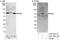 Insulin Like Growth Factor 2 MRNA Binding Protein 1 antibody, A303-423A, Bethyl Labs, Western Blot image 