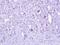 Zinc Finger CCCH-Type Containing 8 antibody, NBP1-32522, Novus Biologicals, Immunohistochemistry frozen image 