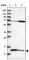 Succinate Dehydrogenase Complex Assembly Factor 3 antibody, HPA020523, Atlas Antibodies, Western Blot image 